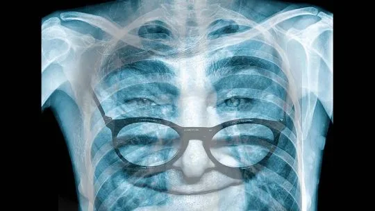 Cuestionan la metodología detrás de la reducción de pobreza en Argentina