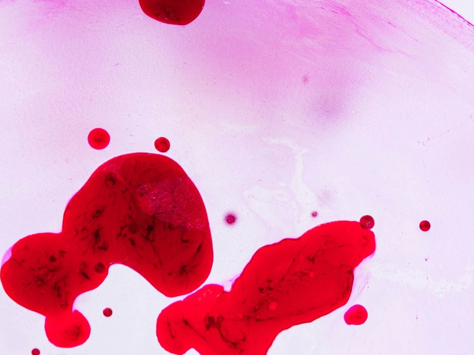 Descubren potencial de vesículas de sangre menstrual para reparar cartílago desgastado