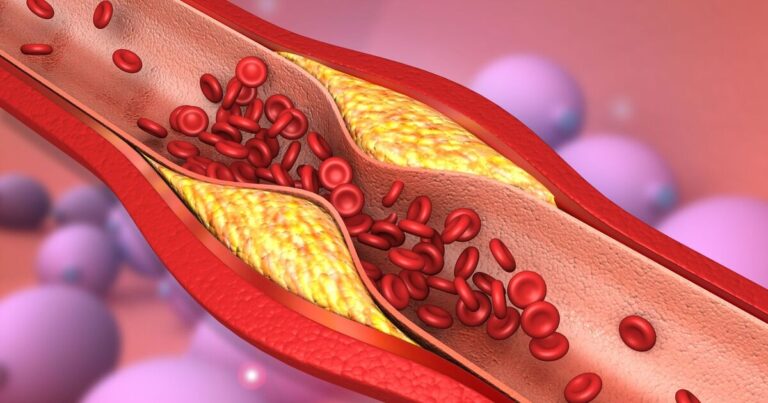 cholesterol-superfood-rivals-aspirin-in-artery-health-says-expert