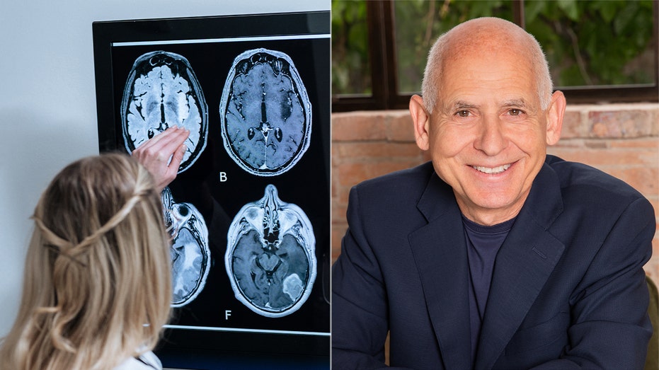 11-lifestyle-changes-to-help-prevent-alzheimer-s-expert-says