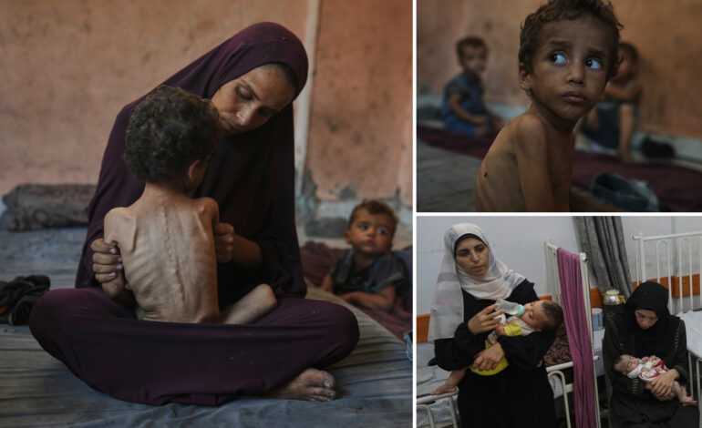 Disturbing Images of Starvation in Gaza Amid Failed Cease-Fire Talks