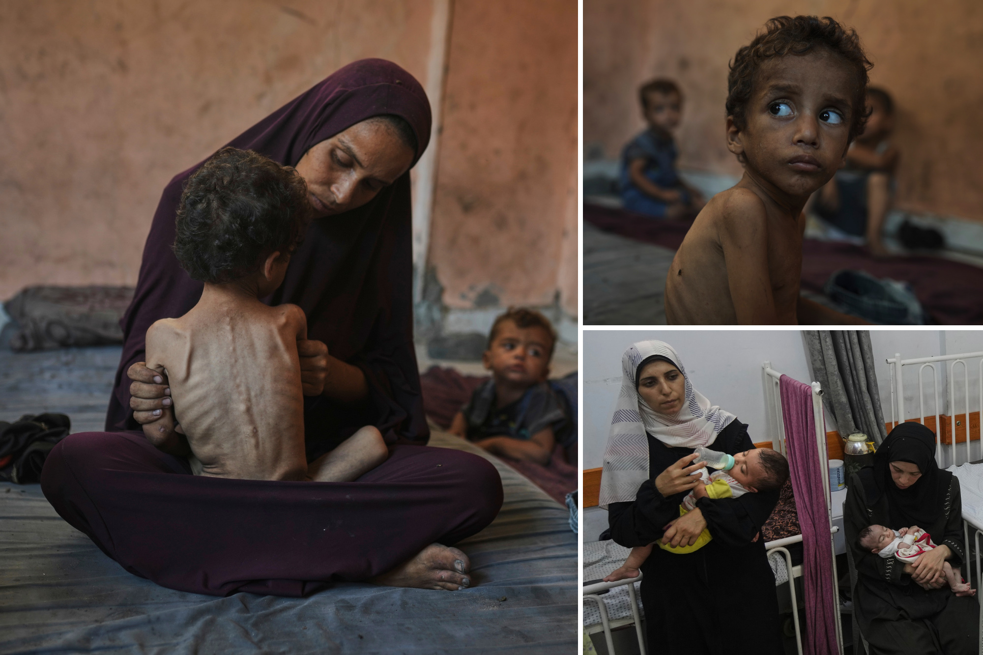 Disturbing Images of Starvation in Gaza Amid Failed Cease-Fire Talks