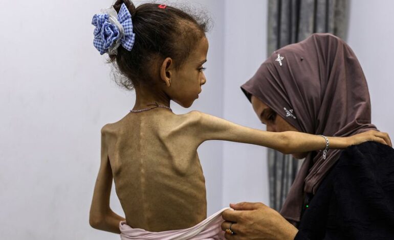 Gaza Faces Famine Crisis as Conflict Escalates, UN Warns