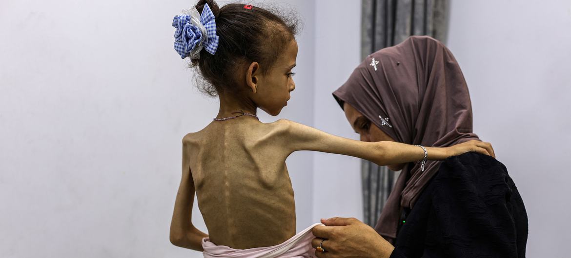 Gaza Faces Famine Crisis as Conflict Escalates, UN Warns