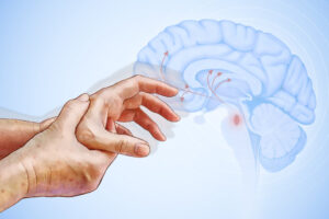 natural-strategies-to-alleviate-symptoms-of-parkinson-s-disease