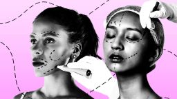 Ozempic-Related Cosmetic Surgery Boom: Patients Seek Solutions