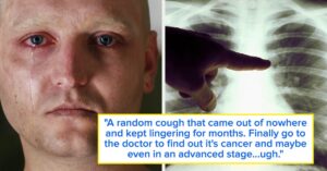 recognizing-early-cancer-symptoms-stories-and-expert-insights