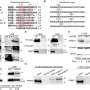 Researchers Uncover Key Protein Fueling Hodgkin Lymphoma Growth