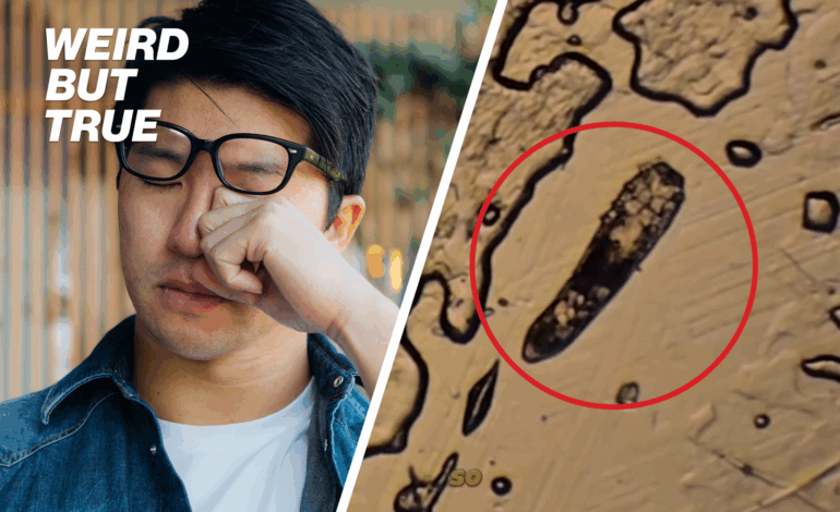 Urgent Alert: Eyelash Mites Found Living on Your Face—Here’s How to Combat Them