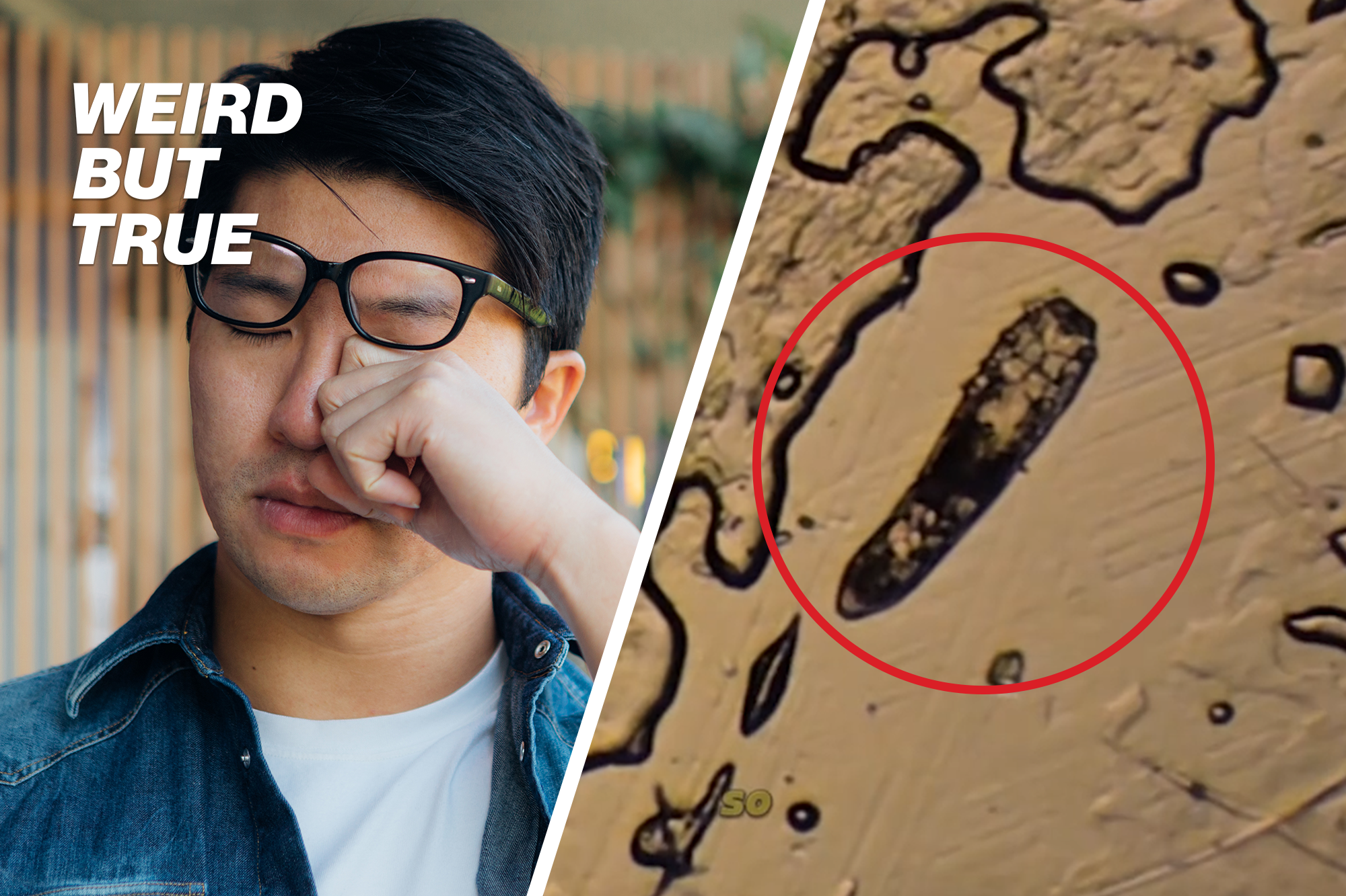 Urgent Alert: Eyelash Mites Found Living on Your Face—Here’s How to Combat Them