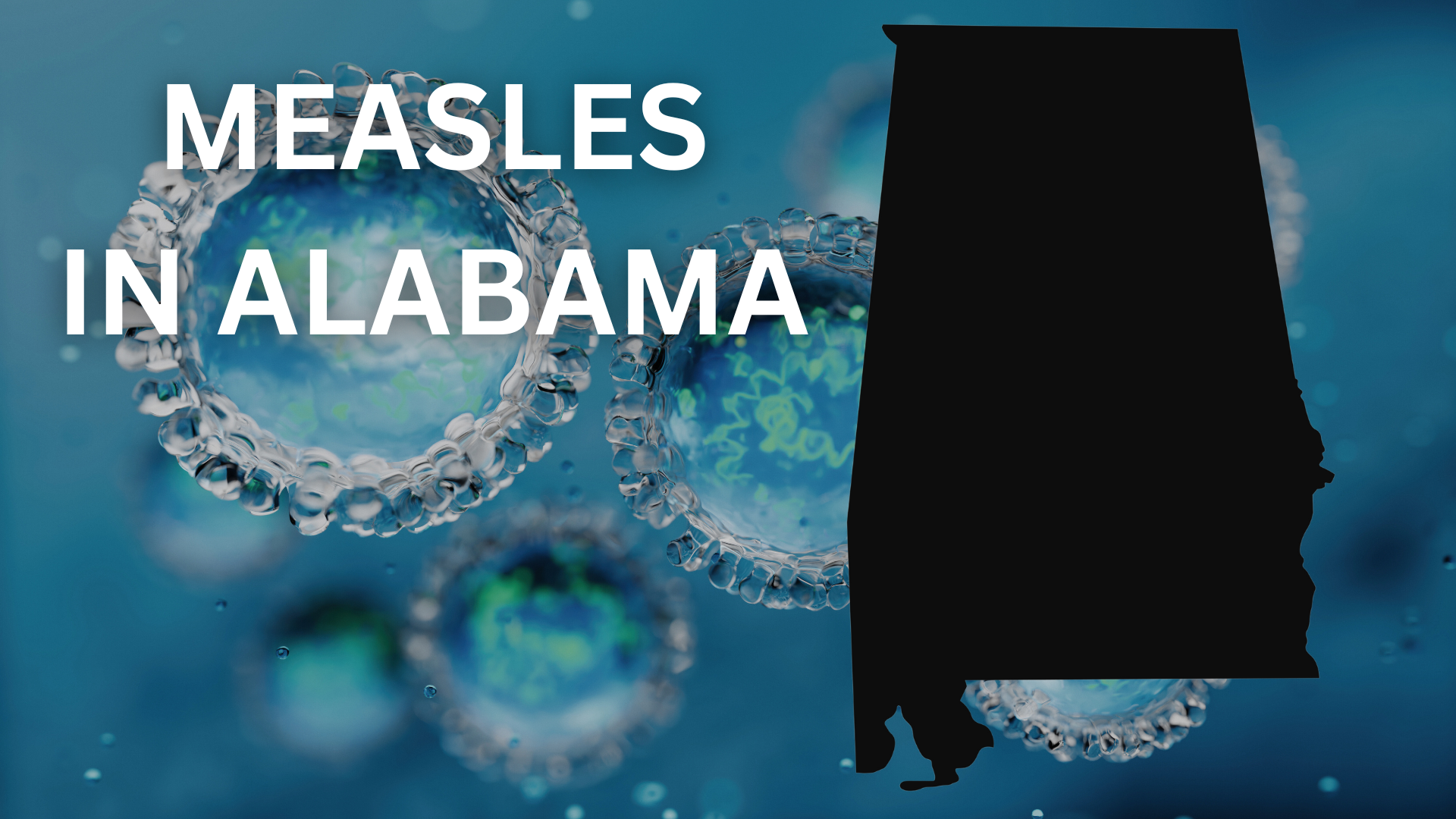 Alabama Reports First Measles Case Since 2002 in Unvaccinated Child