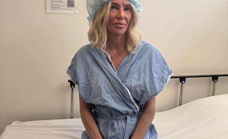 Brandi Glanville Pursues New Treatment for Facial Disfigurement