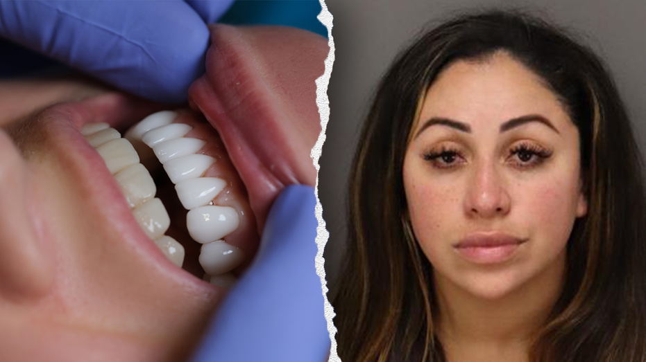 Florida Woman Arrested for Unlicensed Dental Work Using Superglue