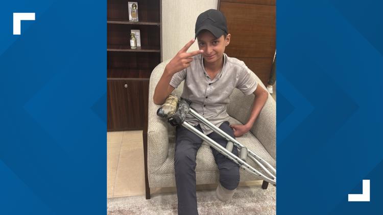 Gaza Boy Begins Healing Journey in Texas After Airstrike Injury