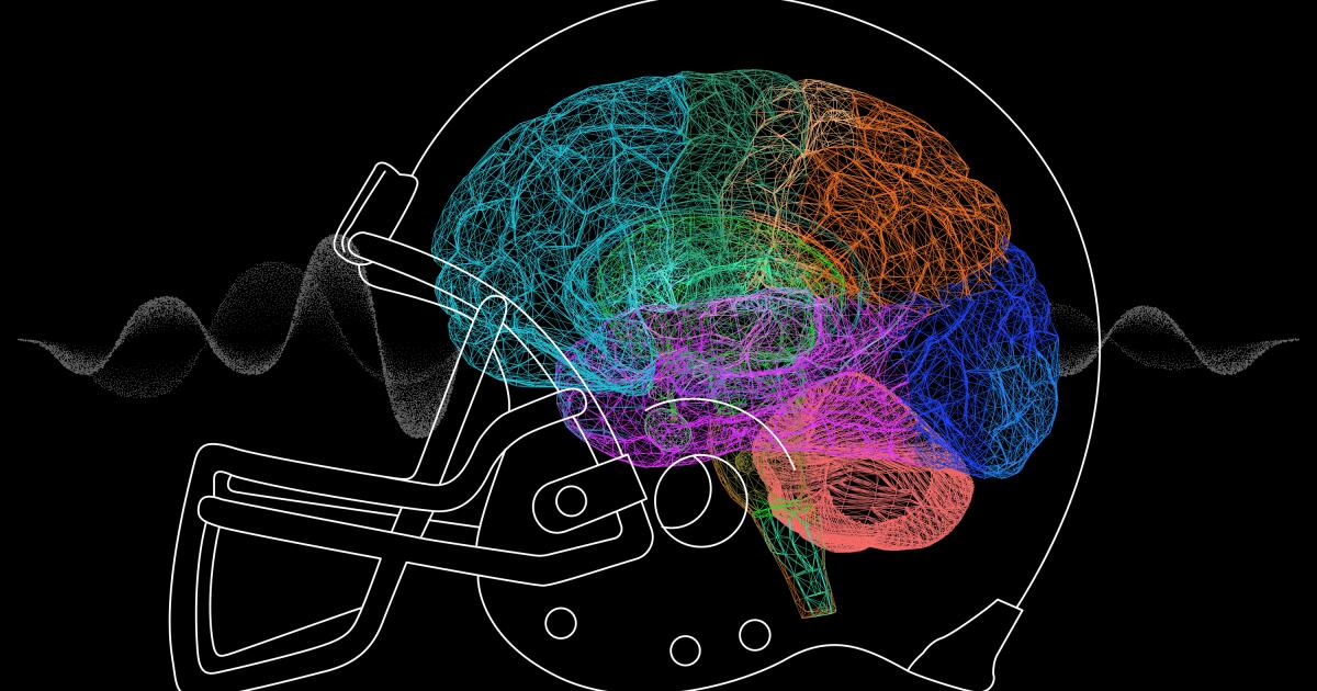 NFL and UFC Athletes Turn to Ibogaine for Brain Injury Relief
