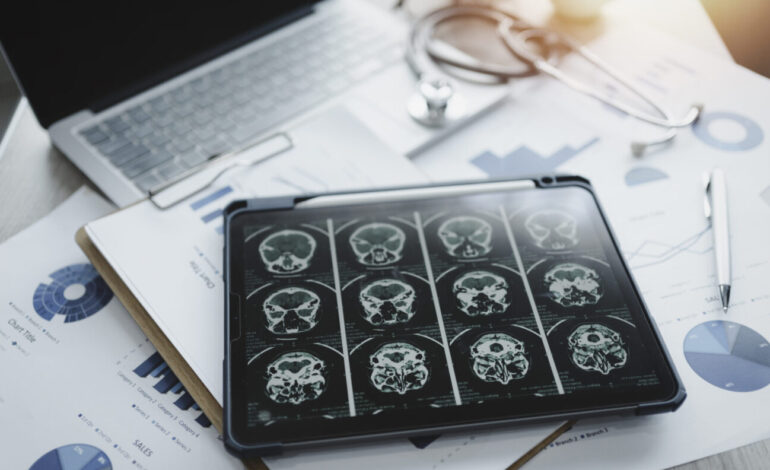 Research Reveals Why Women Face Higher Dementia Risks