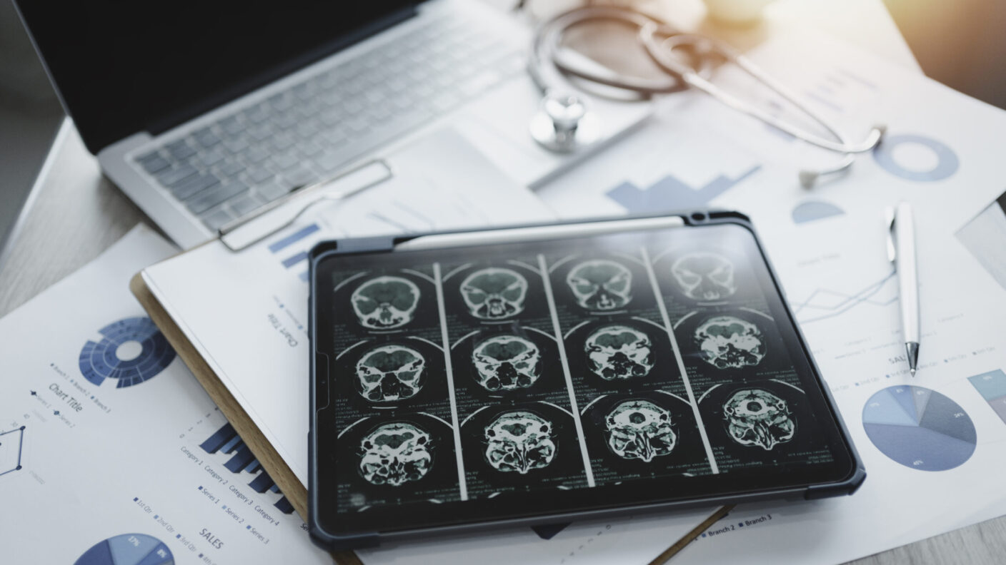 Research Reveals Why Women Face Higher Dementia Risks