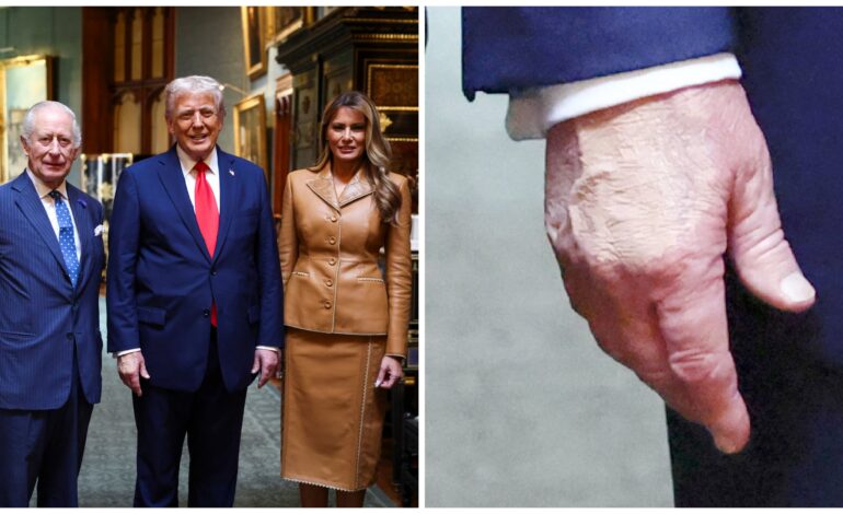 Trump Waves Goodbye to King Charles Amid Makeup Controversy