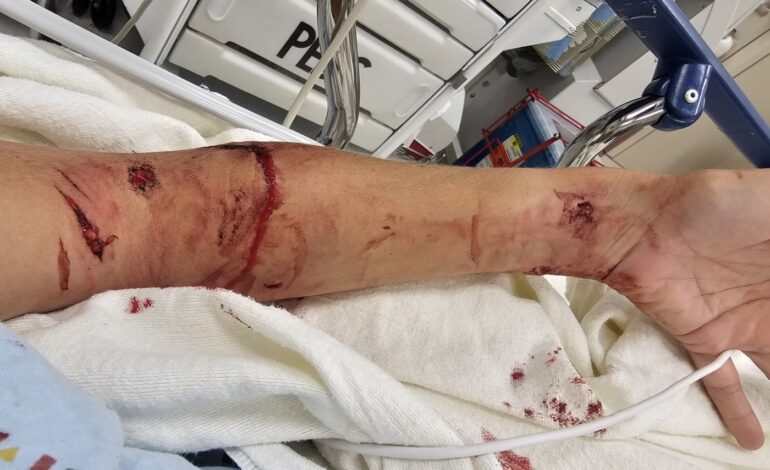 Volunteer Sues Orange County Animal Shelter After Dog Mauling