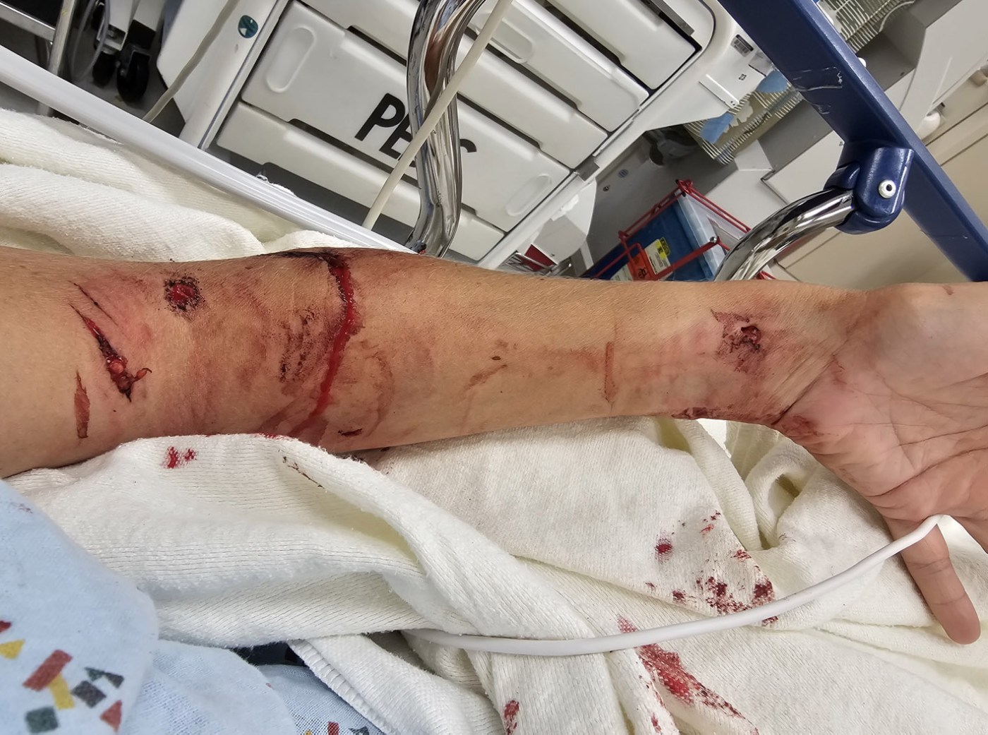 Volunteer Sues Orange County Animal Shelter After Dog Mauling