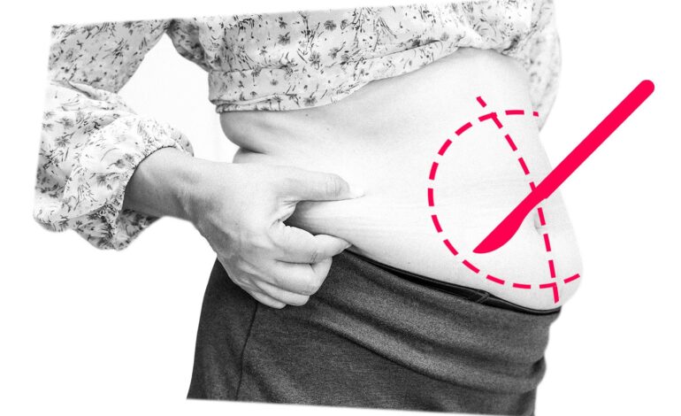 Woman Faces Husband’s Opposition Over Planned Plastic Surgery