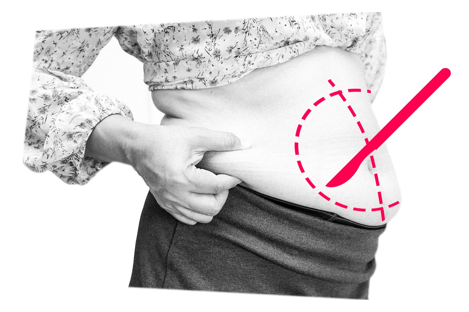 Woman Faces Husband’s Opposition Over Planned Plastic Surgery