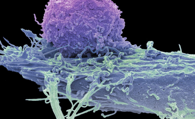 CAR-T Therapies Show Promise in Treating Autoimmune Disorders