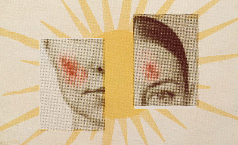 Climate Change Drastically Impacts Skin Health Across the Globe