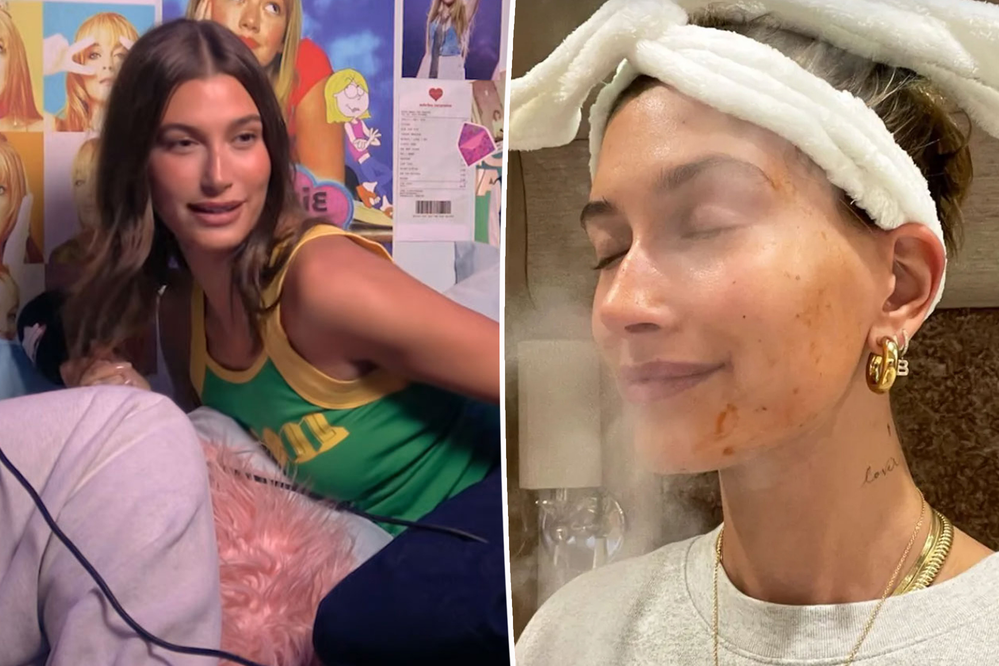 Hailey Bieber Discusses Beauty Treatments and Botox Choices