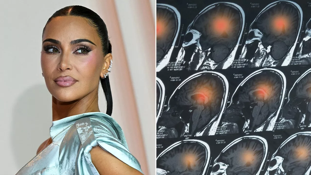 Kim Kardashian Reveals Brain Aneurysm Diagnosis, Experts Weigh In