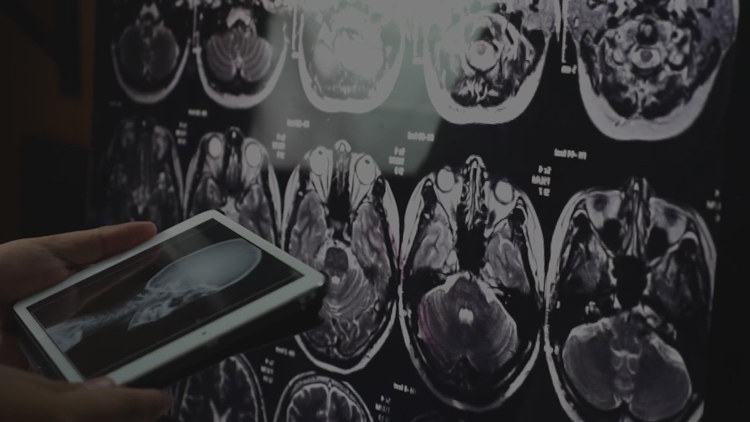 New Study Reveals Lifestyle Changes Can Slow Brain Aging
