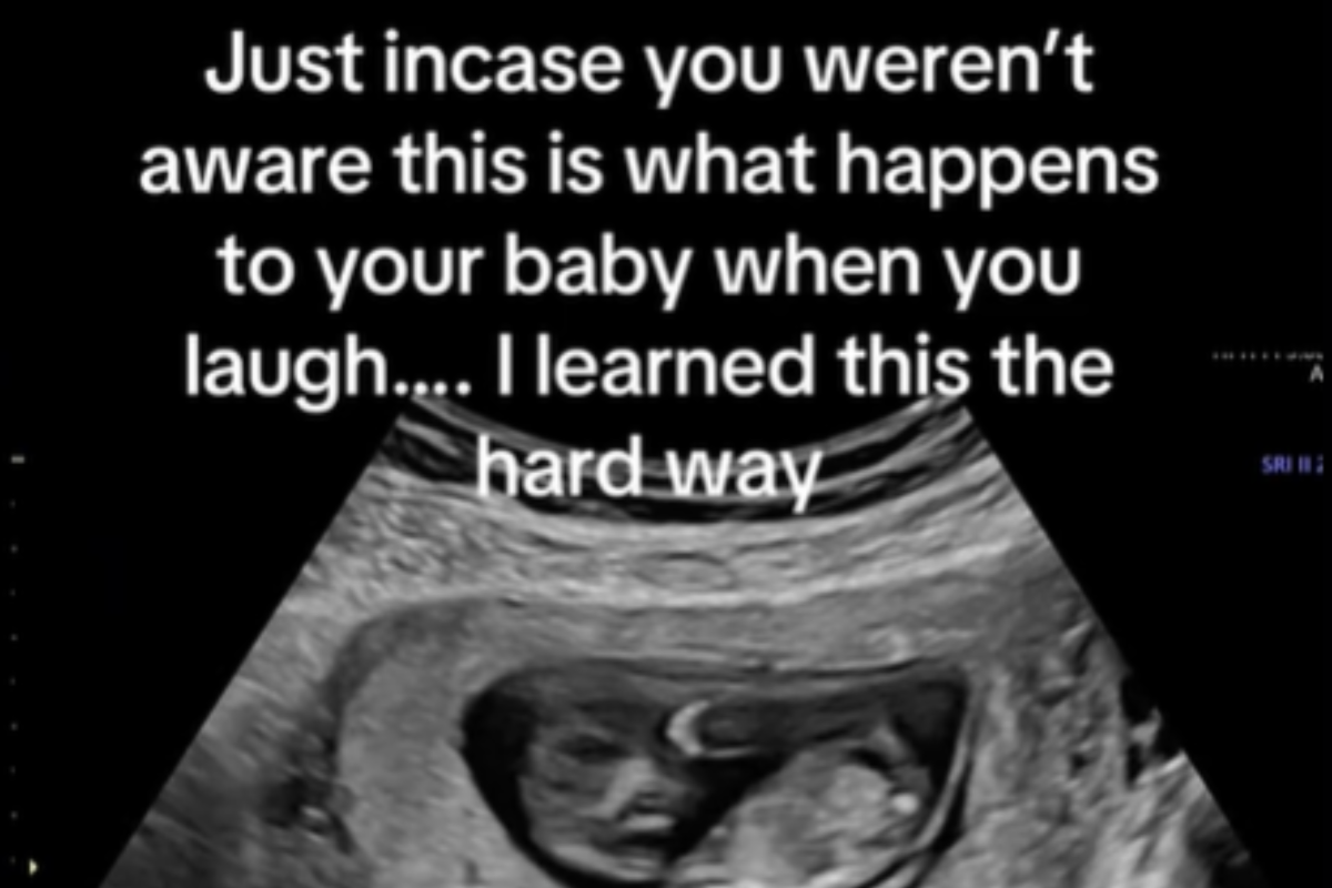 Pregnant Woman’s Laughter Sparks Fascination in Viral Ultrasound Video