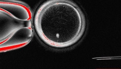 Scientists Create Human Eggs from Skin Cells, Paving Path for Fertility Advances