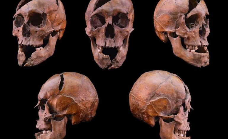 DNA Breakthrough Identifies Violent Fate of Medieval Royalty