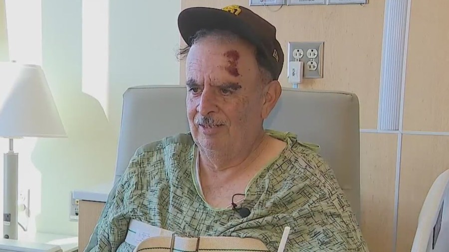 Hit-and-Run Victim in El Cajon Urges Caution Among Drivers