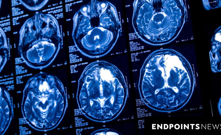 Nuvation Bio Withdraws from Brain Cancer Drug Trial Plans