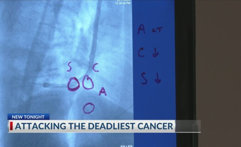 Savannah Hospital Employs Robotic Technology to Combat Lung Cancer
