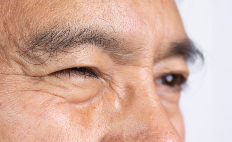 Understanding Eye Twitching: Causes and Remedies Explained