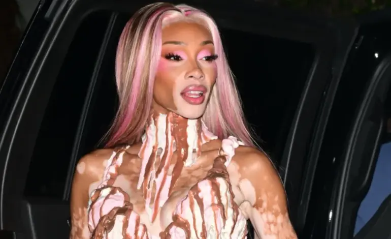 Winnie Harlow Wows Fans with Stunning Ice Cream Costume