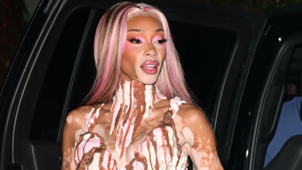 Winnie Harlow Wows Fans with Stunning Ice Cream Costume