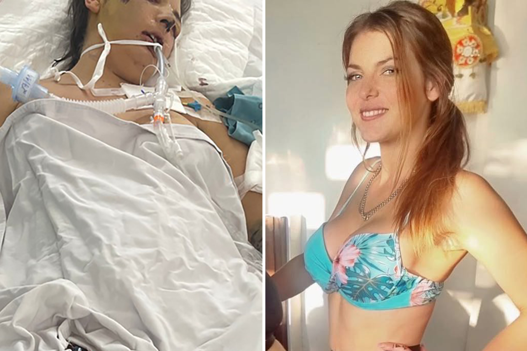 Australian Mother Fights for Life After Cosmetic Surgery in Vietnam