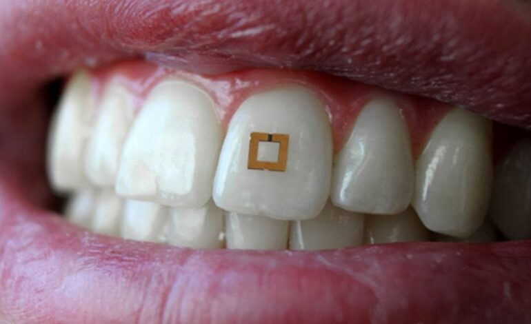 BlancOne Teeth Whitening Revolutionizes Smile Enhancement