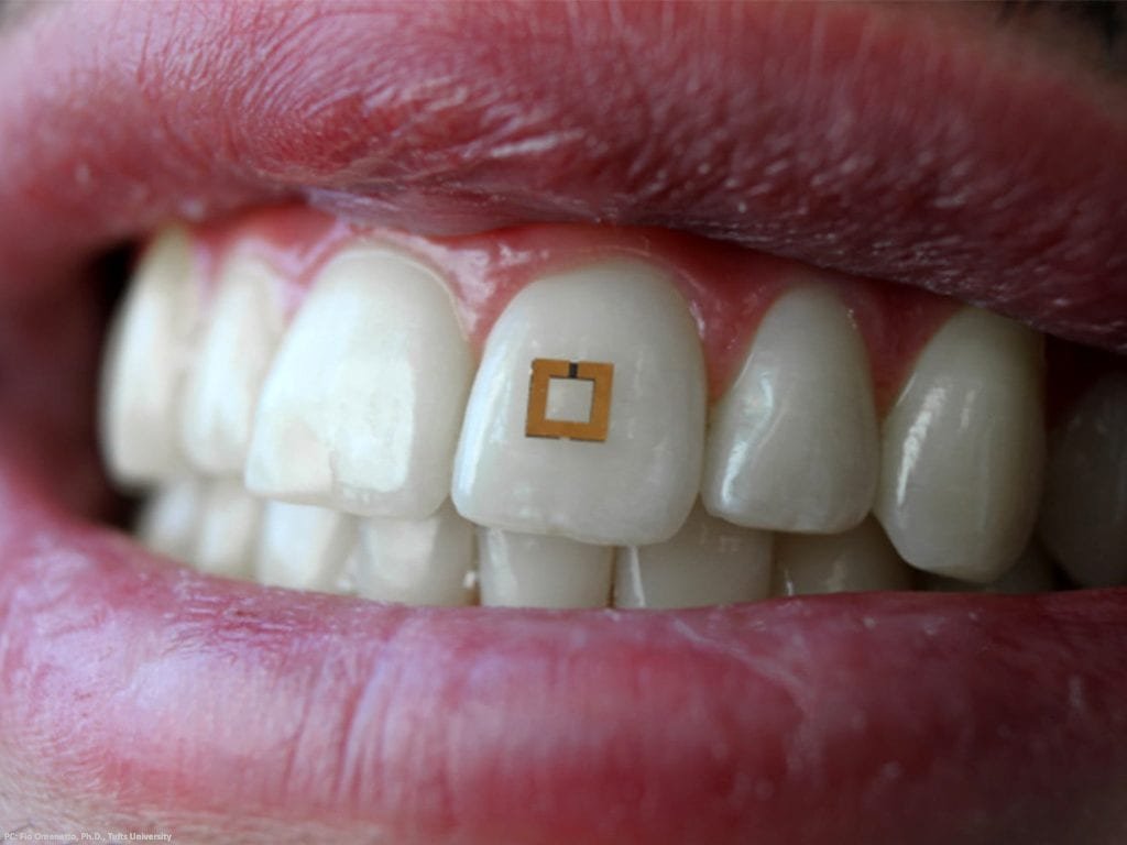 BlancOne Teeth Whitening Revolutionizes Smile Enhancement
