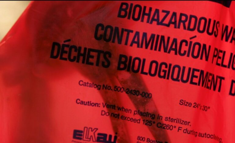 Urgent Lawsuit: San Jose Mortuary Gave Father Son’s Brain