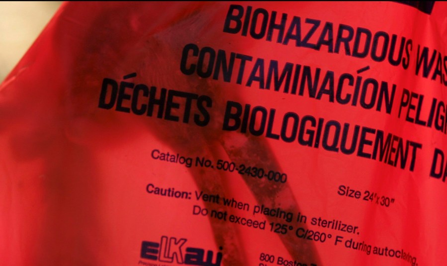 Urgent Lawsuit: San Jose Mortuary Gave Father Son’s Brain