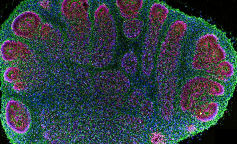 Scientists Convene to Address Ethics of Brain Organoid Research